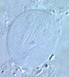 Giardia cyst