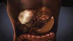 liver