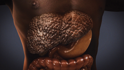 liver