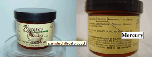 Skin-Lightening Cream with Mercury