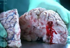 Brain tissue