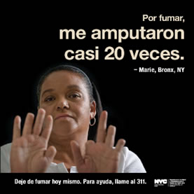 Por fumar, me amputaron casi 20 veces.