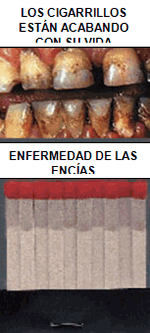 Cigarettes are eating you alive