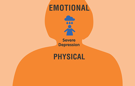 persistent pain model