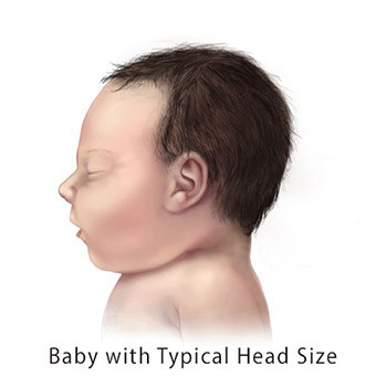 regular headsize