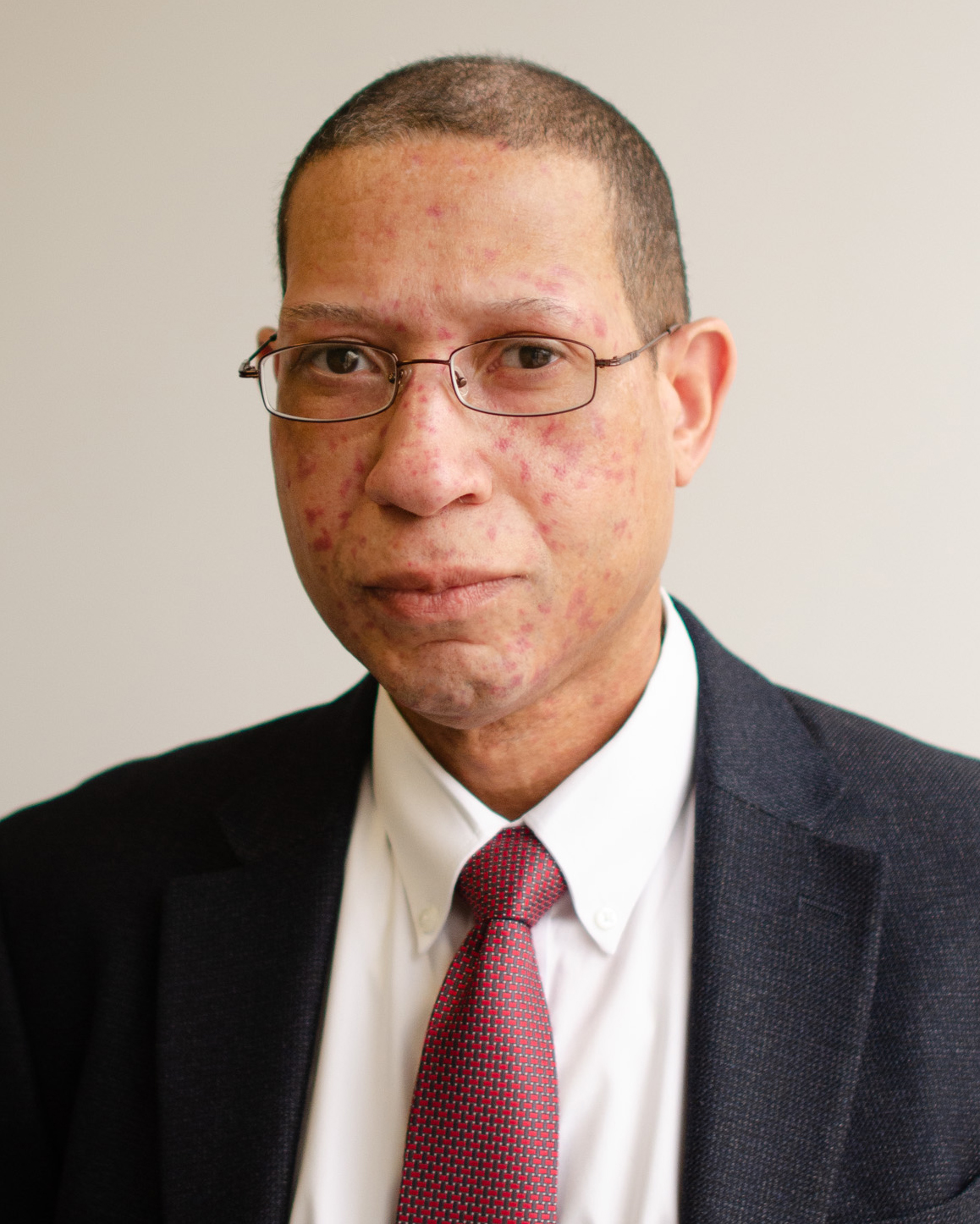 Maurice Dobson, Deputy Commissioner for Legal Affairs