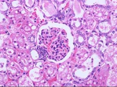 Cell under microscope