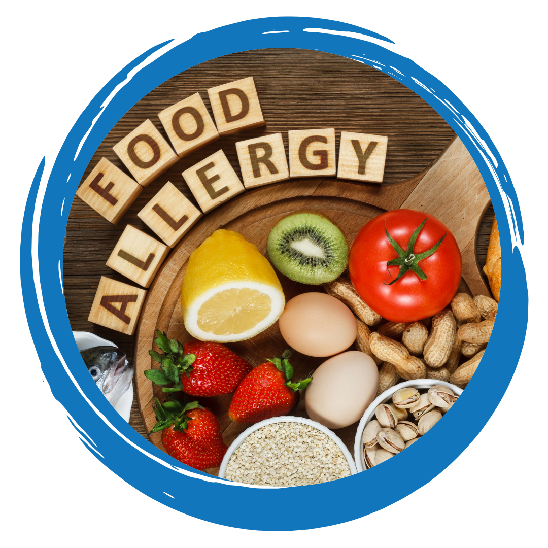 A vessel with various foods inside along with the words Food Allergy