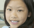 Photo of young girl getting health services